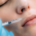 North Bethesda Dermal Filler Trends